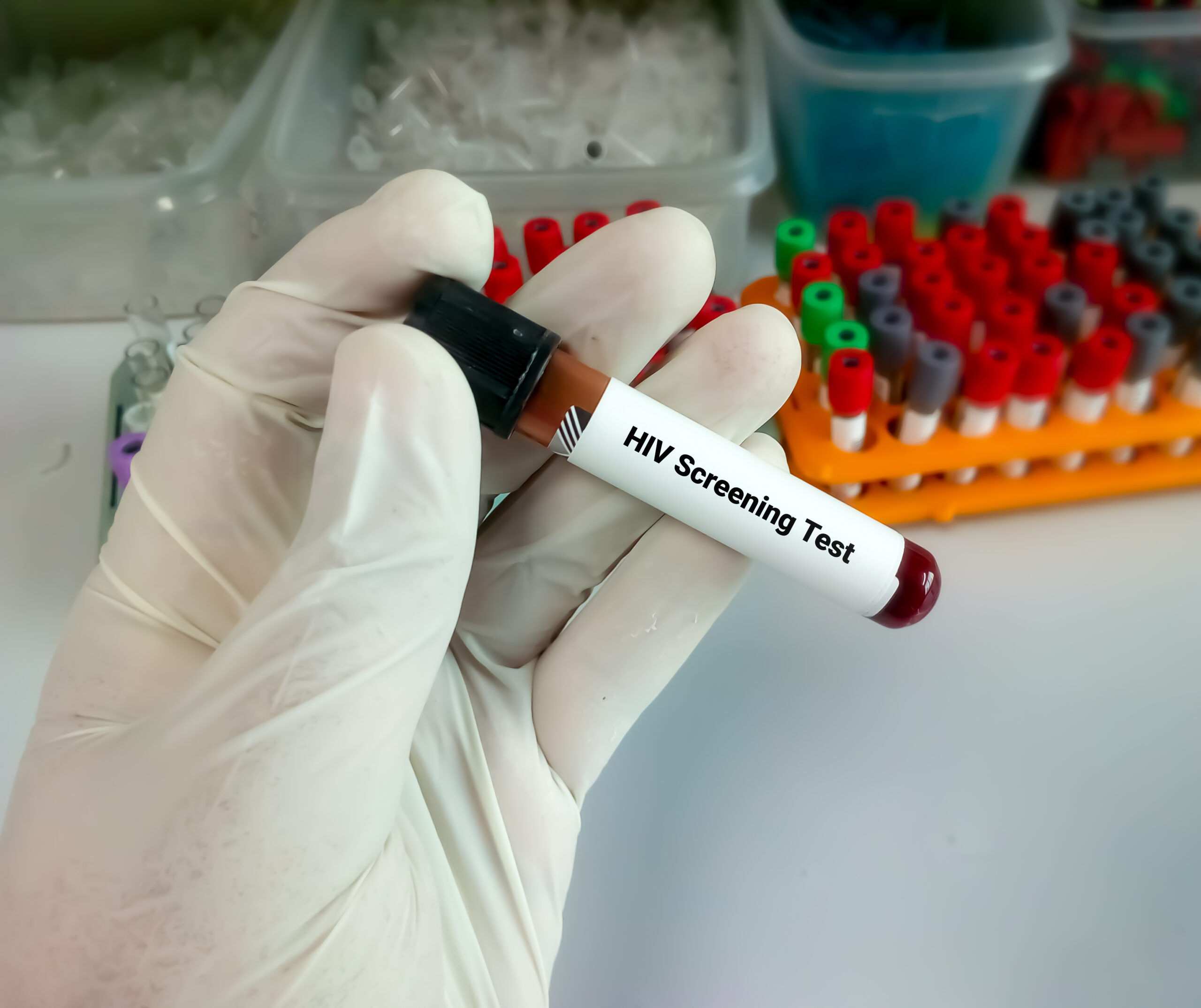 tipos de pruebas de VIH confiables